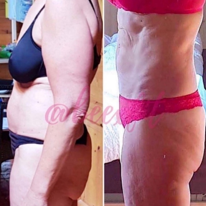 Transformation avant / après d’un membre Beexfit